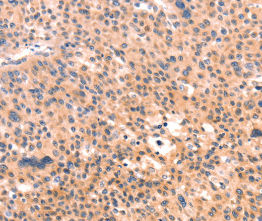 APBA2 Polyclonal Antibody (E-AB-16163)
