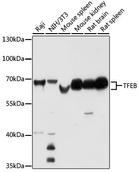 TFEB Polyclonal Antibody (E-AB-67851)