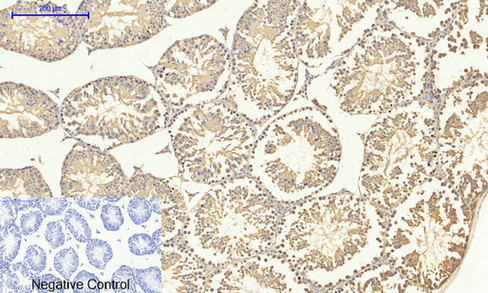 SMAD4 Polyclonal Antibody (E-AB-34159)