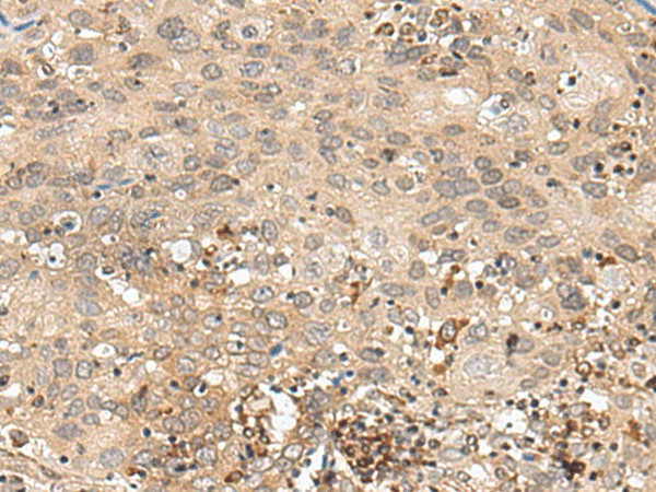 GFI1 Polyclonal Antibody (E-AB-19906)
