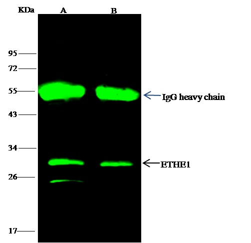 Recombinant ETHE1/HSCO Monoclonal Antibody (AN300124P)