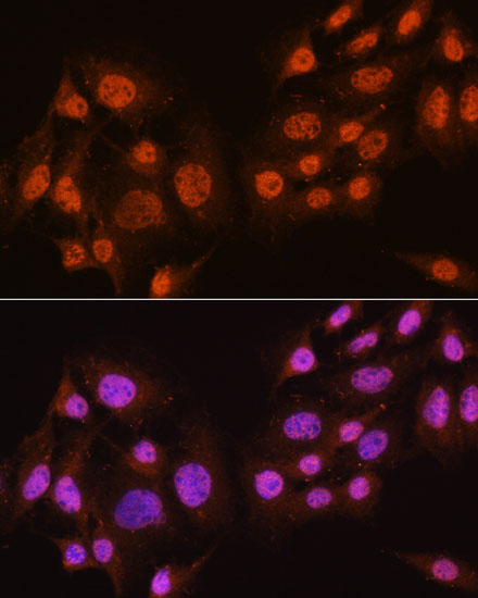 Pan-AKT Polyclonal Antibody (E-AB-67299)