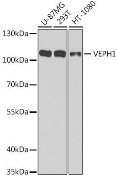 VEPH1 Polyclonal Antibody (E-AB-63175)