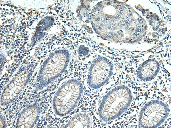 SLC35F6 Polyclonal Antibody (E-AB-53176)