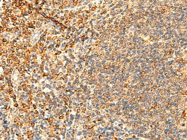 PPM1B Polyclonal Antibody (E-AB-18930)