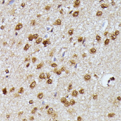KIAA1429 Polyclonal Antibody (E-AB-66723)