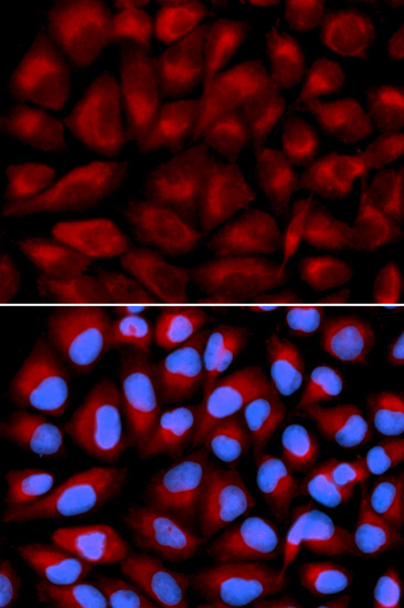 FANCC Polyclonal Antibody (E-AB-60456)