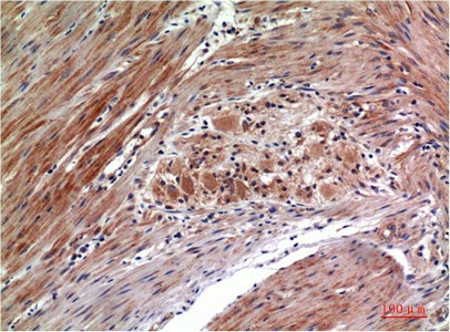 Phospho-ERK 1/2 (Tyr222/205) Monoclonal Antibody (E-AB-51039)