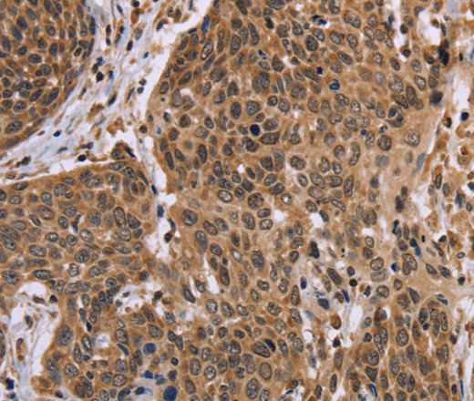EDN2 Polyclonal Antibody (E-AB-14998)