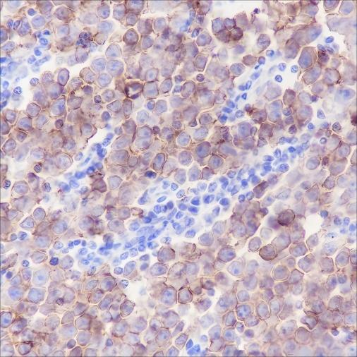 Recombinant c-Kit Monoclonal Antibody (AN301491L)