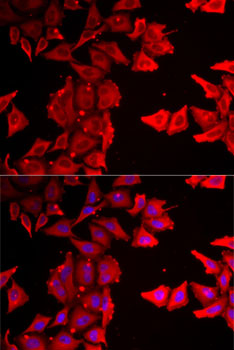 THRSP Polyclonal Antibody (E-AB-61597)
