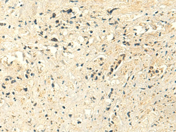 MTHFS Polyclonal Antibody (E-AB-18937)