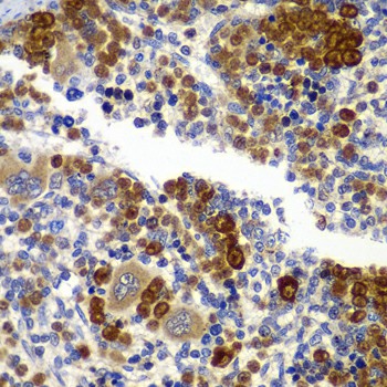 PRKAB1 Polyclonal Antibody (E-AB-62178)