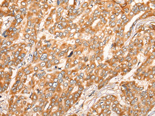 ZMYND10 Polyclonal Antibody (E-AB-52475)