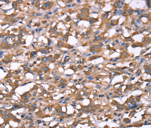 SPAST Polyclonal Antibody (E-AB-16442)
