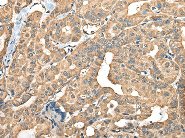 FAM110B Polyclonal Antibody (E-AB-18575)