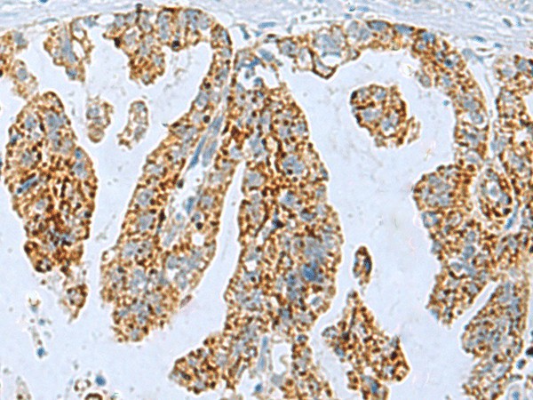 PYCR2 Polyclonal Antibody (E-AB-53146)