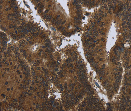 PIP Polyclonal Antibody (E-AB-11260)