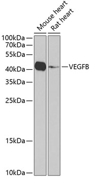 VEGFB Polyclonal Antibody (E-AB-67412)