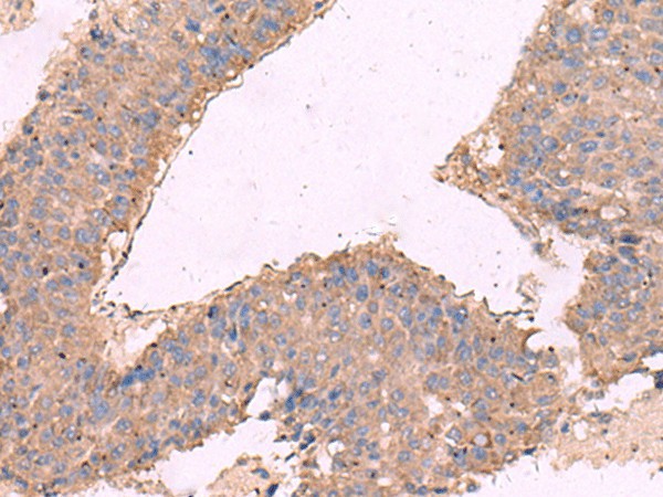 KCNN3 Polyclonal Antibody (E-AB-18172)
