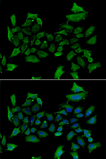 ALAS1 Polyclonal Antibody (E-AB-64653)