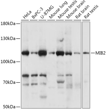 MIB2 Polyclonal Antibody (E-AB-91924)