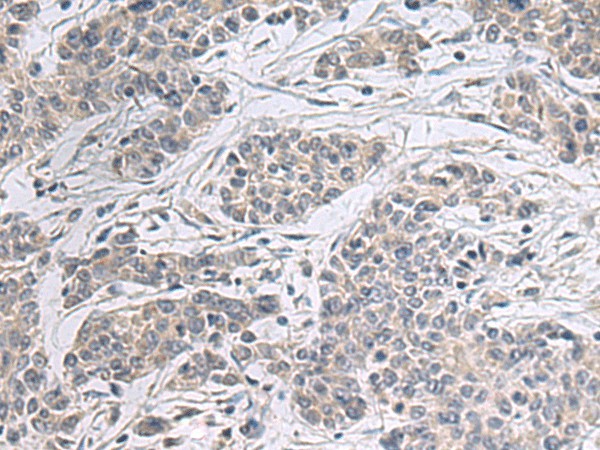 PPM1K Polyclonal Antibody (E-AB-53177)