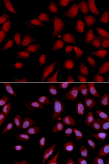 DLGAP5 Polyclonal Antibody (E-AB-60679)