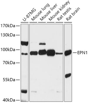 EPN1 Polyclonal Antibody (E-AB-91869)