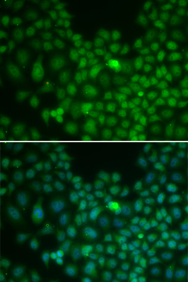 CLU Polyclonal Antibody (E-AB-64664)
