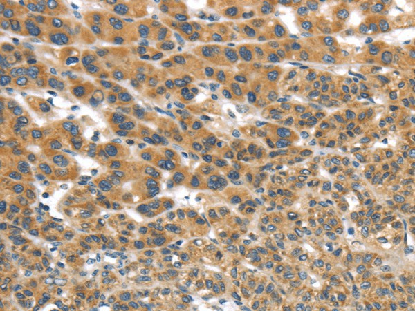 UBTD2 Polyclonal Antibody (E-AB-17505)