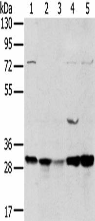 TPD54 Polyclonal Antibody (E-AB-16936)