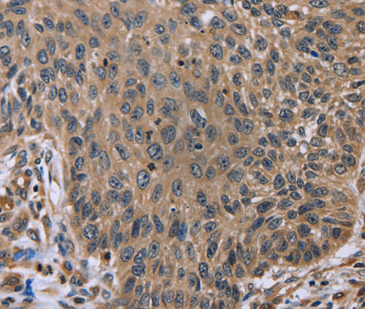 EDA Polyclonal Antibody (E-AB-14972)