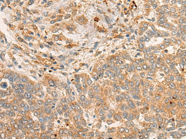 FBXO32 Polyclonal Antibody (E-AB-17885)