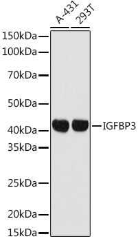 IGFBP3 Polyclonal Antibody (E-AB-91410)