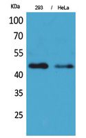 IDH1 Polyclonal Antibody (E-AB-30163)