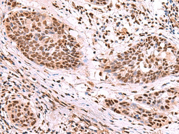 SF3B3 Polyclonal Antibody (E-AB-19022)
