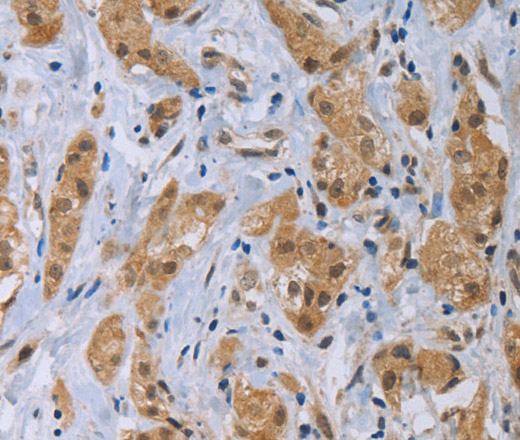 CLEC1A Polyclonal Antibody (E-AB-14004)