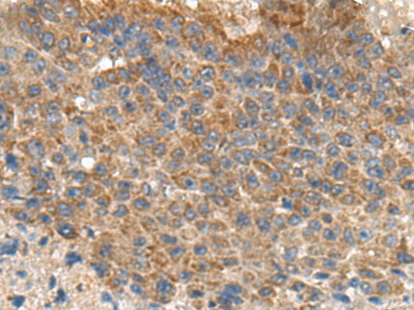 MIA Polyclonal Antibody (E-AB-53035)