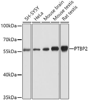 PTBP2 Polyclonal Antibody (E-AB-62506)