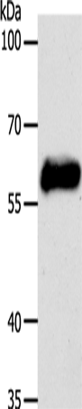 CK-10 Polyclonal Antibody (E-AB-16127)