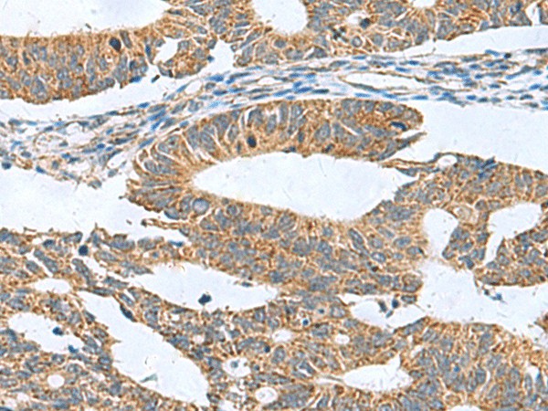 CLEC1B Polyclonal Antibody (E-AB-18219)