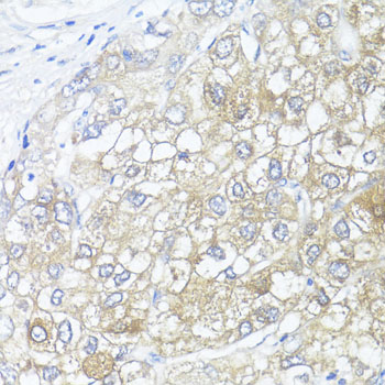 ASL Polyclonal Antibody (E-AB-61903)