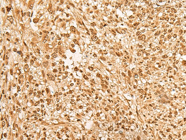 JPT2 Polyclonal Antibody (E-AB-18789)