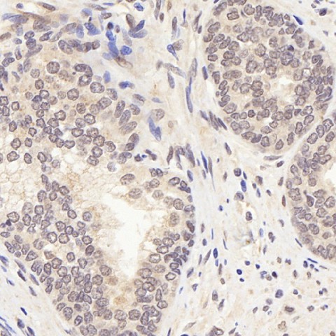 AR Polyclonal Antibody (E-AB-70112)
