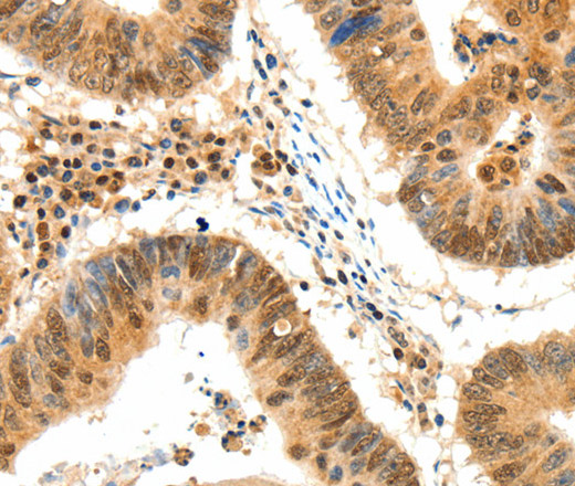 TERF2 Polyclonal Antibody (E-AB-15871)