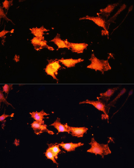 FLCN Polyclonal Antibody (E-AB-66299)