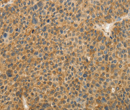 TFPI2 Polyclonal Antibody (E-AB-10641)