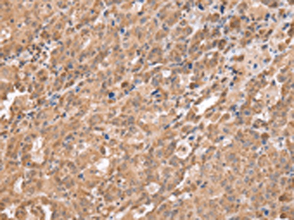 DDX58 Polyclonal Antibody (E-AB-53369)