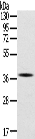 SPARC Polyclonal Antibody (E-AB-10612)